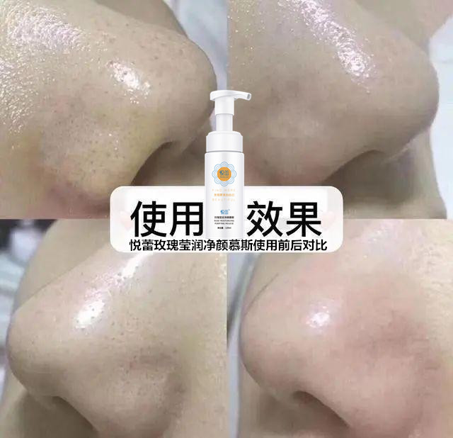 a686c9177f3e67093d147c7df0e46d34f9dc55cd_副本.jpg a686c9177f3e67093d147c7df0e46d34f9dc55cd_副本.jpg